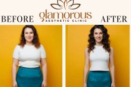 Before and After Liposuction In Riyadh & Saudia Arabia