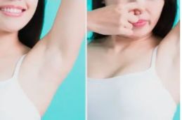 Before and after laser hair removal in Riyad