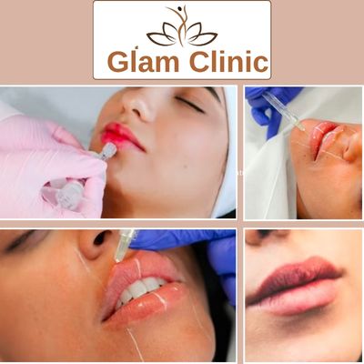 Lip Fillers injection in Riyadh Saudia Arabia
