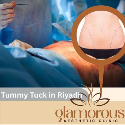 Tummy Tuck in Riyadh