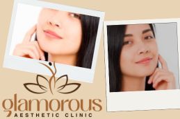 before and After Glutathione injections in Riyadh Saudia