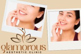 before and After Glutathione injections in Riyadh Saudia Arabia