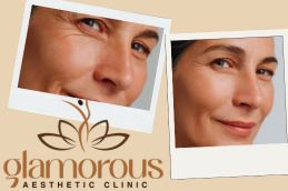 before and After Result Cosmetic Injectables in Riyadh Saudia