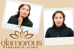 before and After Result Glutathione injections in Riyadh Saudia