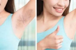 Laser Hair Removal Riyad saudia