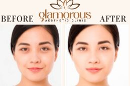 Before and After Result Cosmetic Surgery in Riyadh & Saudia