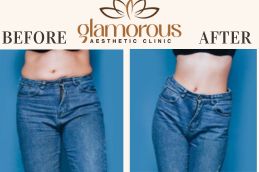 Before and After Result Cosmetic Surgery in Riyadh