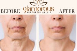 Before and After Result Cosmetic Surgery
