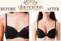 Before and After result breast Surgery Riyadh KSA (1)