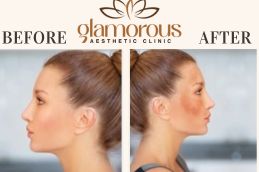 Before and After results of dermatologists in Saudia
