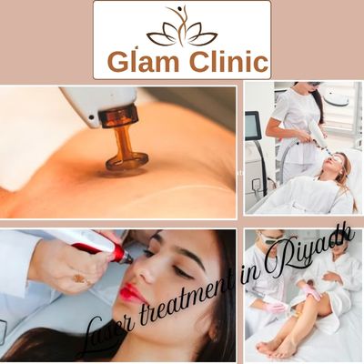 Laser treatment in saudia ,riyadh